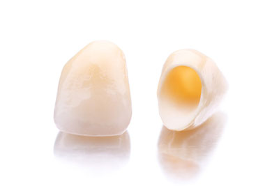 If You Don’t Like Your Smile, Visit A CEREC Dentist In Tracy