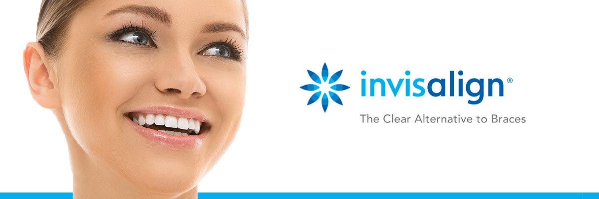Tracy Invisalign for Teens