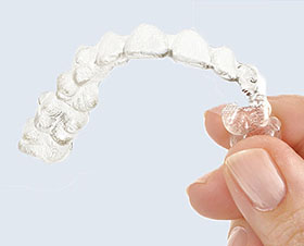 7 Things Parents Need to Know About Invisalign Teen