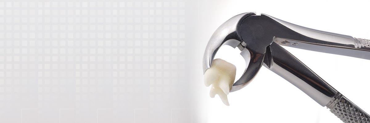 Tracy Tooth Extraction